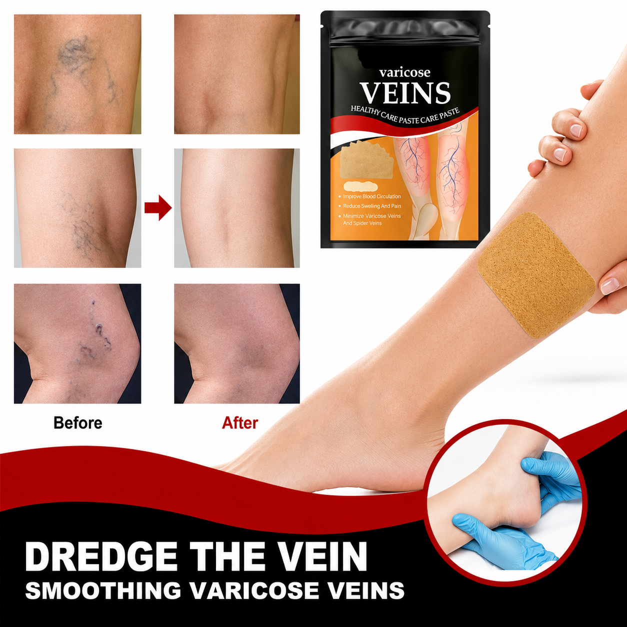 varicose veins Patch,  High-quality Sheet Material ,Set Of 12 Patches