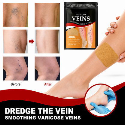 varicose veins Patch,  High-quality Sheet Material ,Set Of 12 Patches